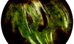 Позеленели воды при родах, причины и последствия