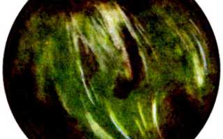 Позеленели воды при родах, причины и последствия