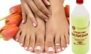 Можно ли использовать белизну для лечения грибка ногтей на ногах?