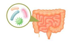 Дисбактериоз кишечника – лечение препаратами и народными средствами