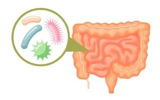 Дисбактериоз кишечника – лечение препаратами и народными средствами