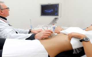 УЗИ поджелудочной железы – подготовка к процедуре исследования