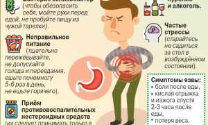 Омепразол: инструкция, цена, отзывы