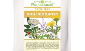 Какие травы нужно применять при лечении псориаза?