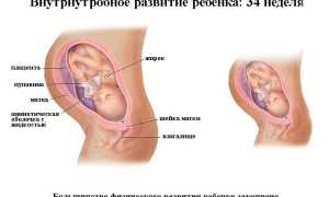 Особенности родов на 34 неделе