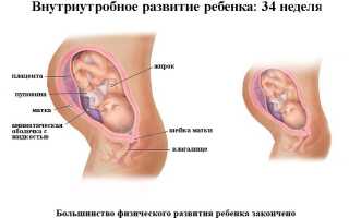 Особенности родов на 34 неделе