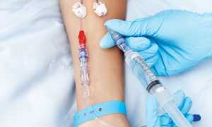 Консервативная терапия аппендицита — эффективность, противопоказания и последствия