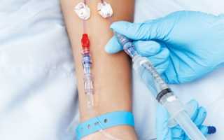 Консервативная терапия аппендицита — эффективность, противопоказания и последствия