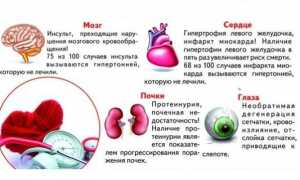 Признаки гипертонического криза у женщин, лечение болезни
