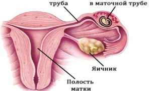 Критические периоды во время беременности