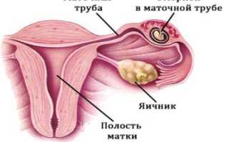 Критические периоды во время беременности