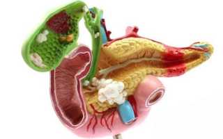 Застой в желчном пузыре — причины возникновения, симптомы, диагностика, лечение и профилактика