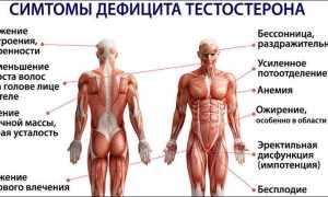 Недостаток тестостерона у мужчин — причины, симптомы, диагностика, препараты и народные средства лечения