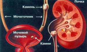 Кишечные колики при беременности
