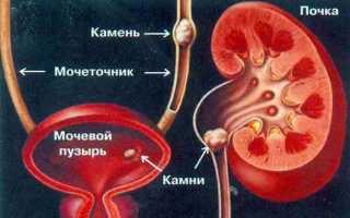Кишечные колики при беременности