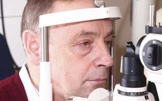 Пресбиопия – что это такое, причины возникновения и симптомы заболевания глаз, диагностика и коррекция