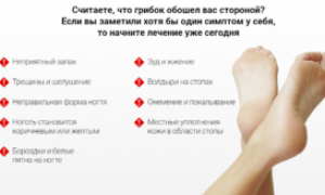Как лечить запущенную форму грибка ногтя?