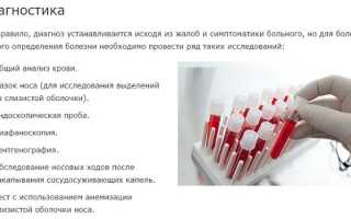 Холодовой ринит: симптомы и лечение аллергического насморка