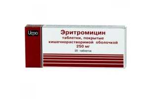 Паховый лимфаденит у мужчин и женщин — причины и симптомы воспаления