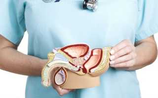 Анализ секрета простаты — показания, цели и расшифровка результатов