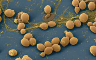 Методы лечения молочницы в ротовой полости у ребенка