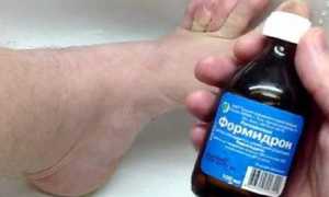 Эффективный помощник в борьбе с грибком и не только — Формидрон