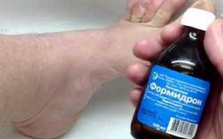 Эффективный помощник в борьбе с грибком и не только — Формидрон