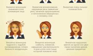 Признаки инсульта у женщин: симптомы и предвестники