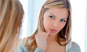 Герпес при беременности