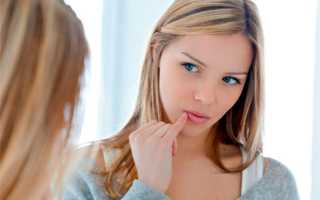 Герпес при беременности