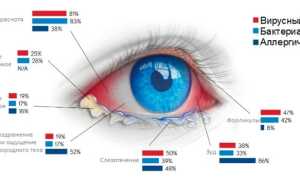 Конъюнктивит у детей — чем лечить в домашних условиях