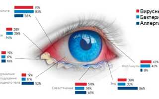 Конъюнктивит у детей — чем лечить в домашних условиях