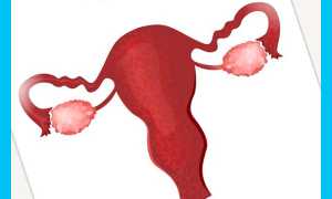 Гирудотерапия при бесплодии: помогут ли пиявки забеременеть