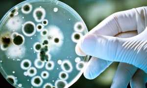 Профилактика амебиаза у детей и взрослых — способы и методы предотвращения заболевания