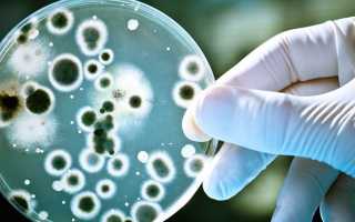 Профилактика амебиаза у детей и взрослых — способы и методы предотвращения заболевания