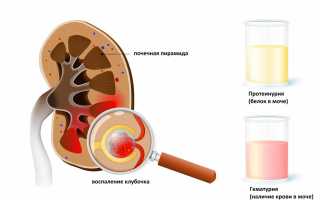 Какие анализы мочи и крови сдают при заболевании почек