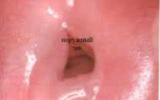 Шейка матки чистая: что это значит, расшифровка