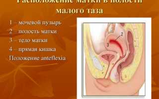Что такое антеверсия матки?