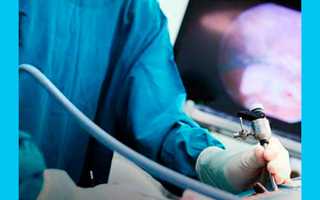 Лонгидаза при планировании беременности: помогает или нет