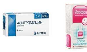 Лечение хронического синусита у взрослых и детей