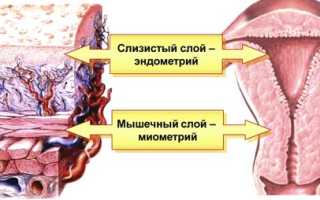 Что такое миометрий матки?