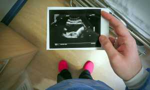 Первые положительные признаки после подсадки эмбриона