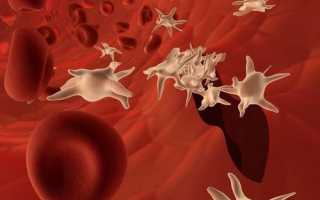 Причины повышенных тромбоцитов при беременности