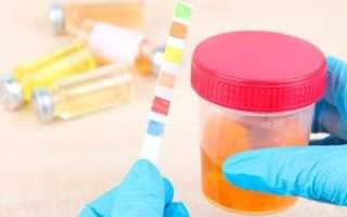 Почему появляется плохой анализ мочи при беременности?