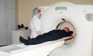 Менингиома головного мозга: лечение без операции