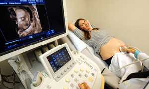 Доплерометрия при беременности