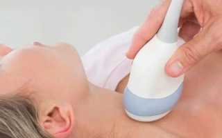 Норма щитовидной железы у женщин и детей — показания к назначению исследования и расшифровка результатов