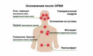 Антибиотики при ОРВИ — список препаратов для детей и взрослых