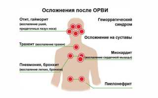 Антибиотики при ОРВИ — список препаратов для детей и взрослых