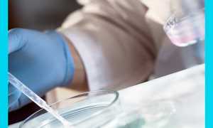 Проба Курцрока-Миллера: современная проверка совместимости половых партнеров